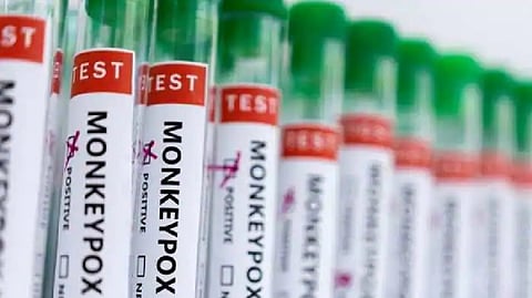 Representative Image