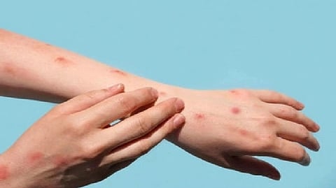 Representative Image