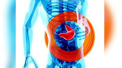 Representative Image