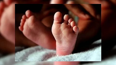 Representative image