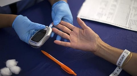 Representative Image