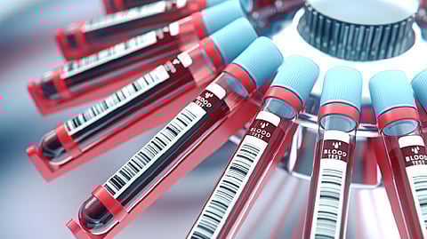 Representative image