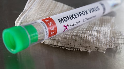 Representative image