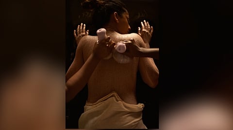 Representative image