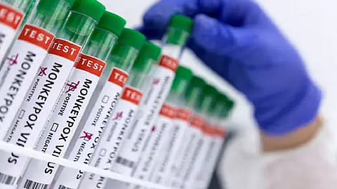 Representative image