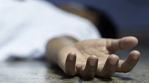 Representative image