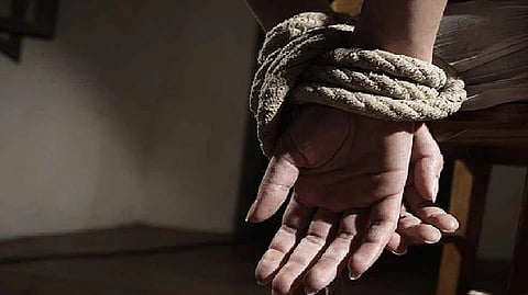 Representative image