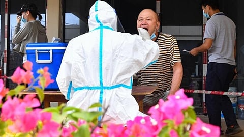 Representative Image