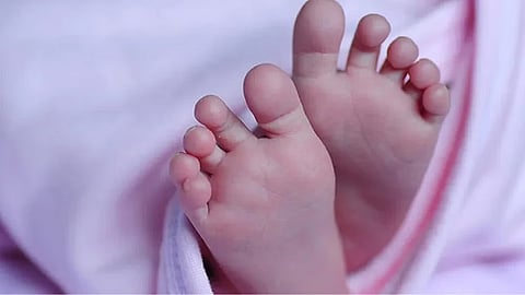 Representative image