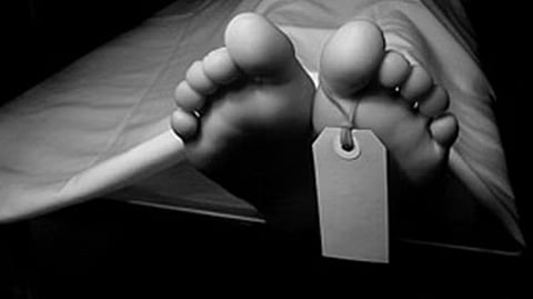 Representative image