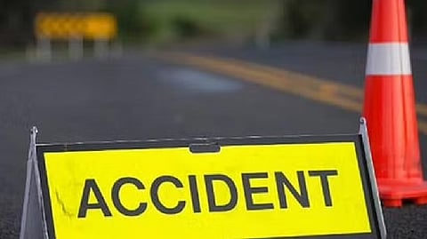 Representative Image