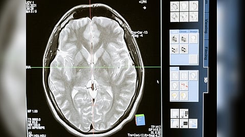 Representative image