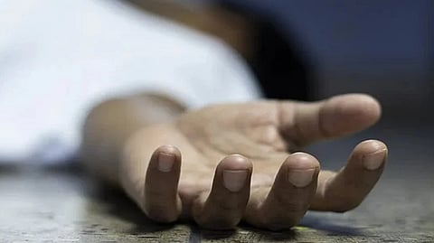 Representative image