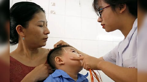 Representative Image