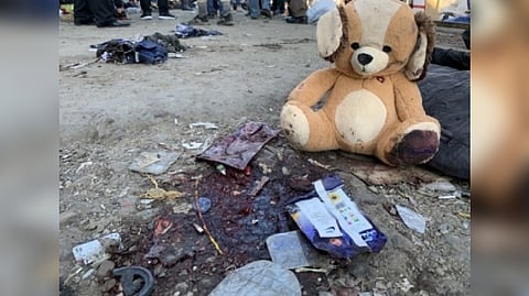 Representative Image