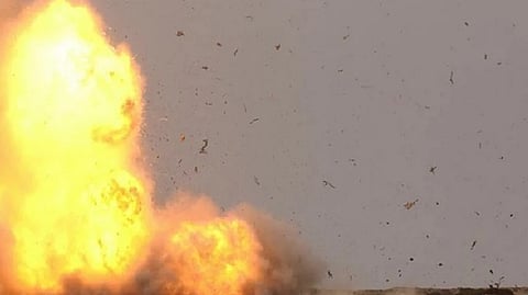 Representative image