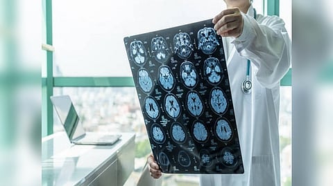 Representative image