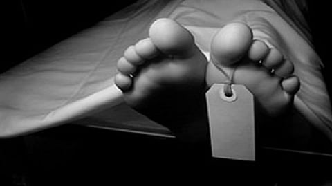 Representative Image