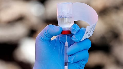 Representative image