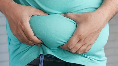 Representative image