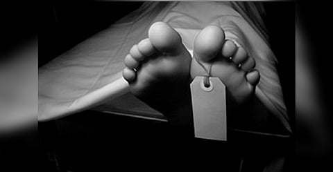 Representative Image