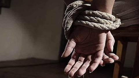 Representative image