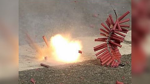 Representative Image