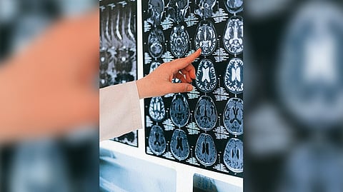 Representative Image