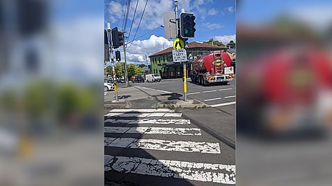 Representative image