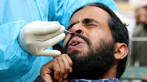 Representative image