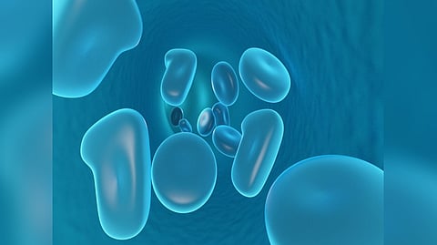 Representative image