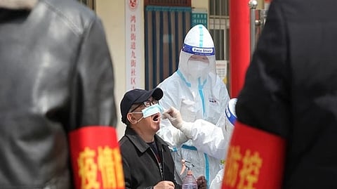 Representative Image