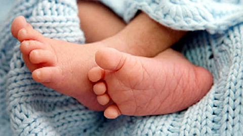 Representative Image