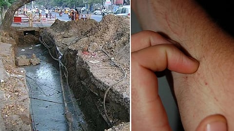 Representative image