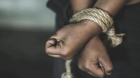 Representative image