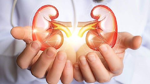 Representative Image