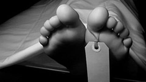 Representative image