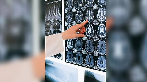 Representative Image