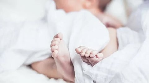 Representative image