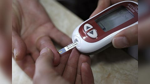 Representative image