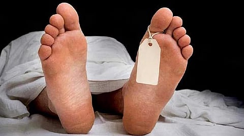 Representative image