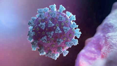 Representative image