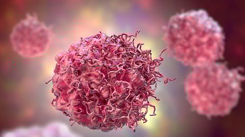 Representative image