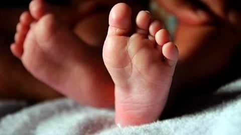 Representative image