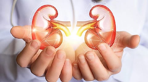 Representative image