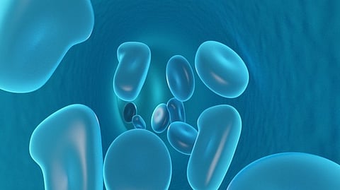 Representative Image