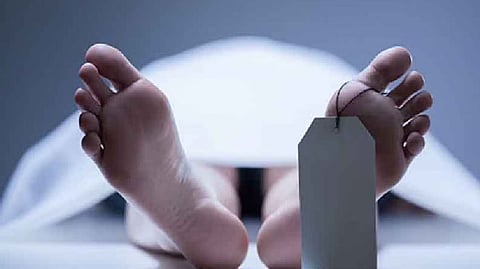 Representative image