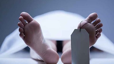 Representative image