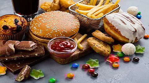 Representative image