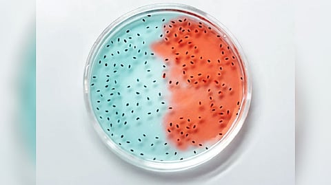 Representative image